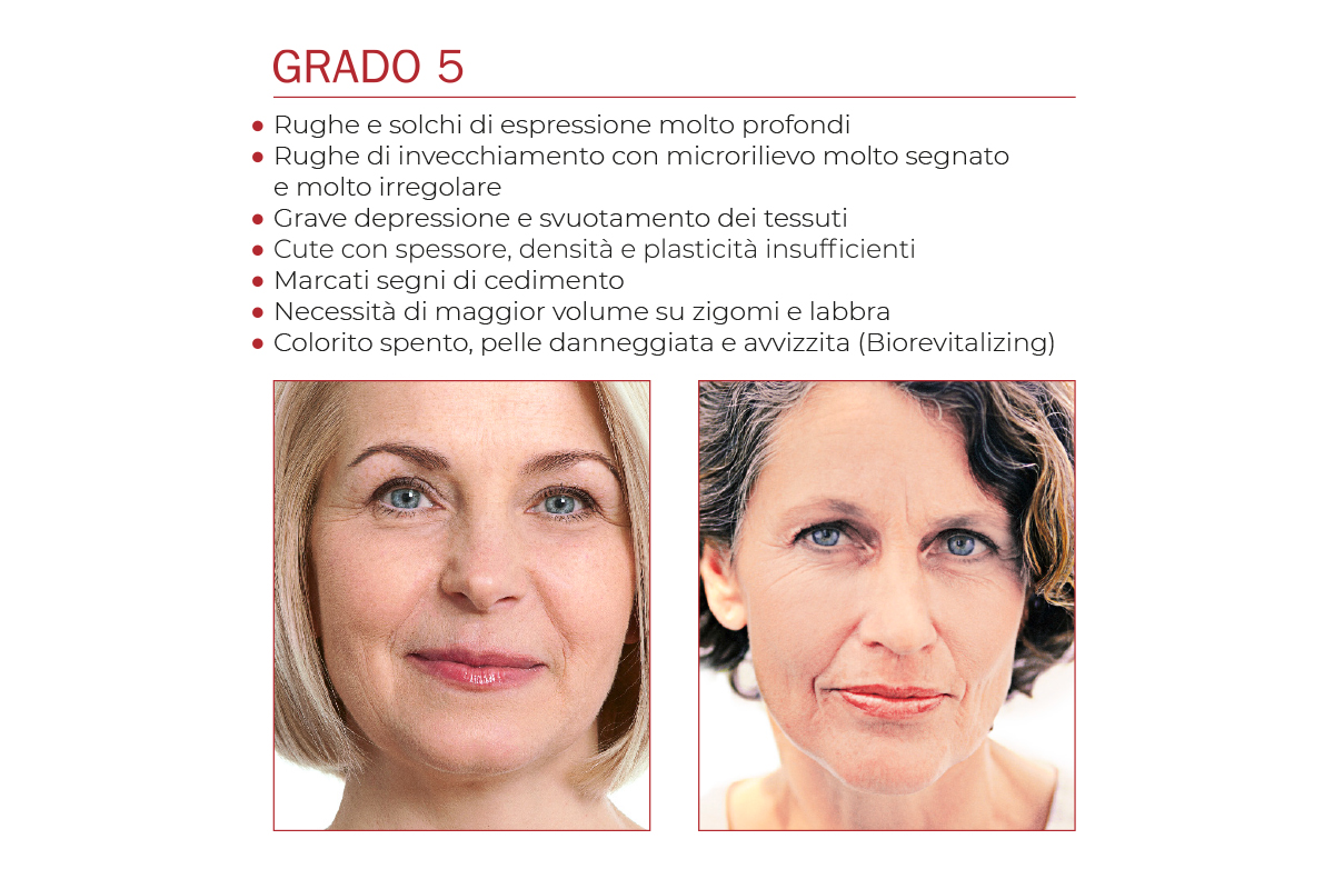 fillerina-gr.5