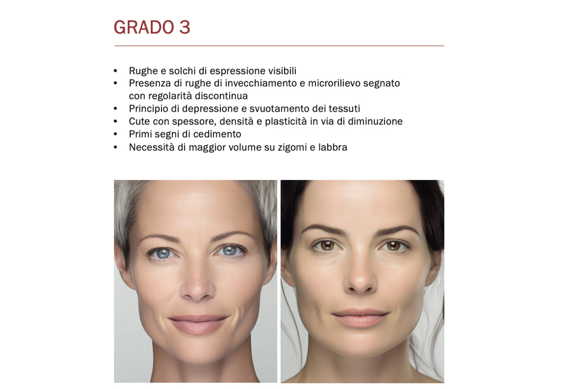 Fillerina 15HA grado 3