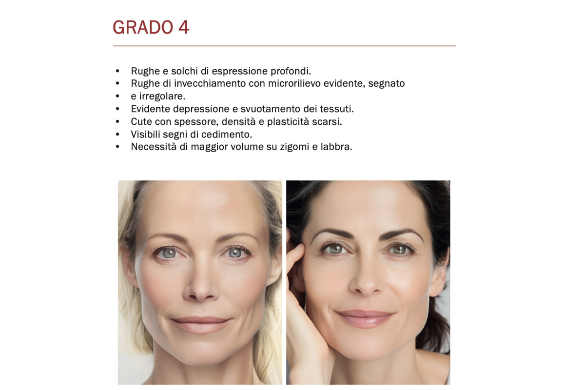 Fillerina 15HA grado 4