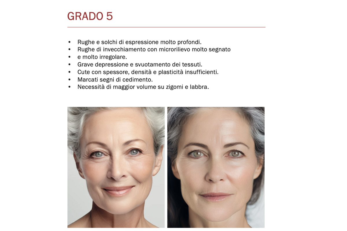 Fillerina 15HA grado 5