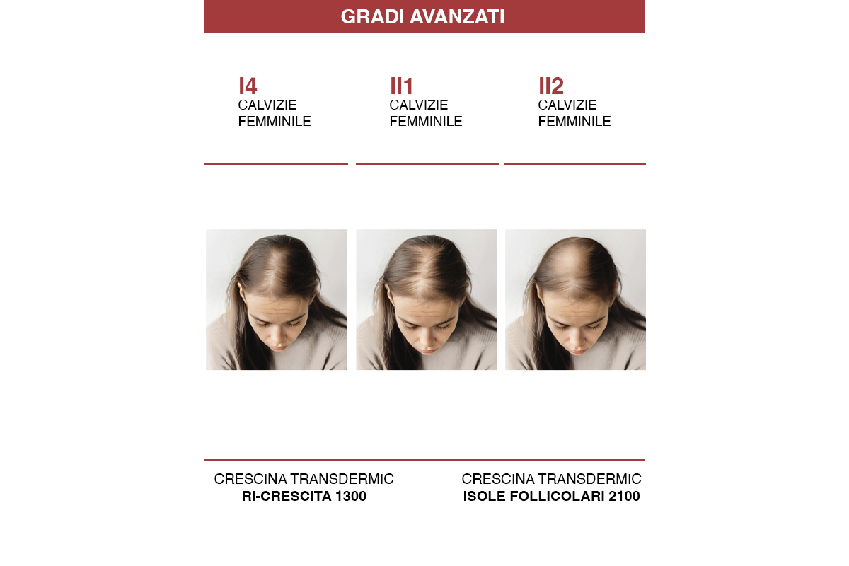 Crescina Diradometro – grado avanzato donna